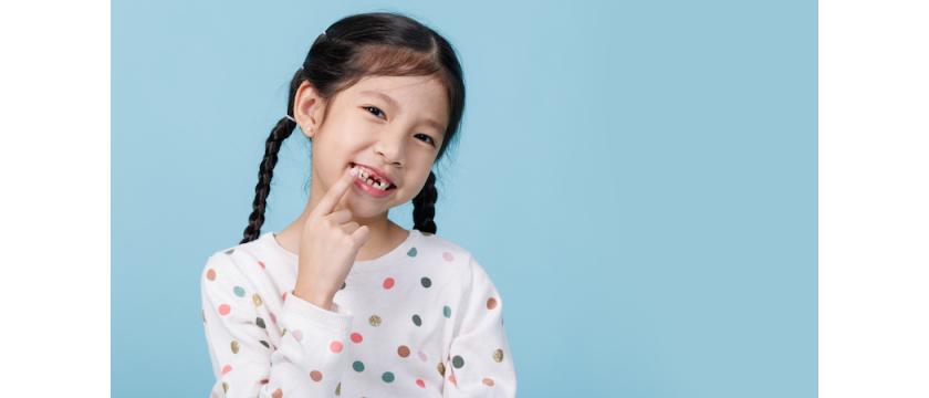 I denti storti nei bambini, un problema che si può evitare?