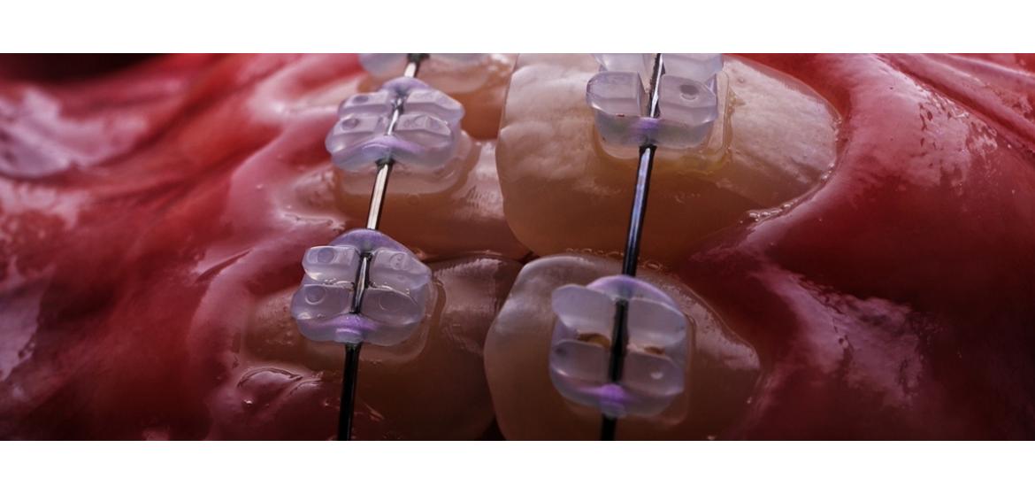 Line Aligners Per Carpfishing Kit Terminali Per Pesca Alla Carpa - Foto 10